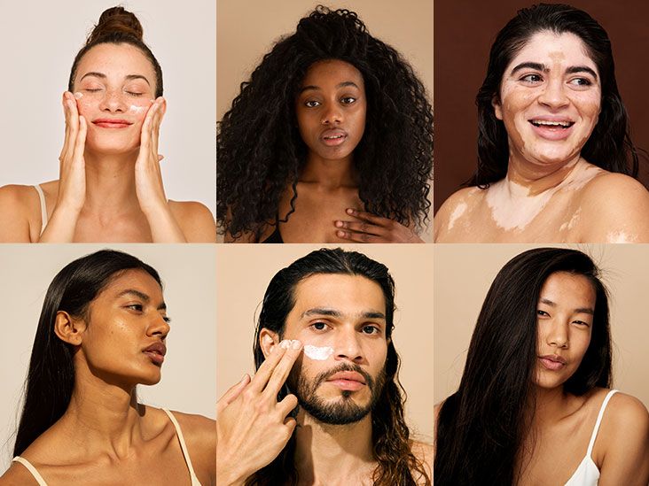 مقال طبي: تطوير مفهوم نوع البشرة لتبني التنوع الحقيقي